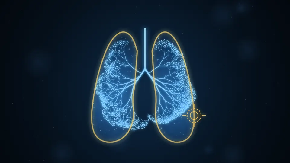 Other Pleural Procedures illustration