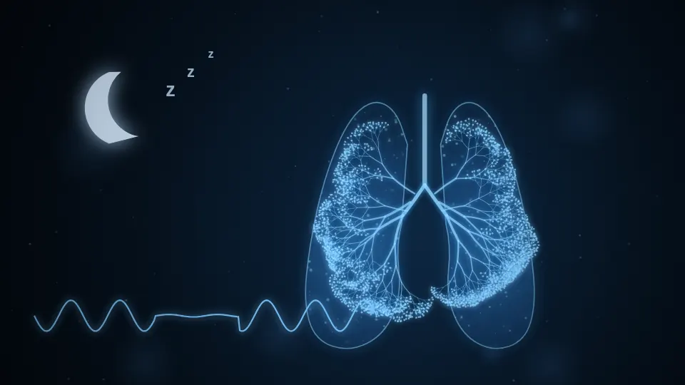 Obstructive Sleep Apnoea illustration