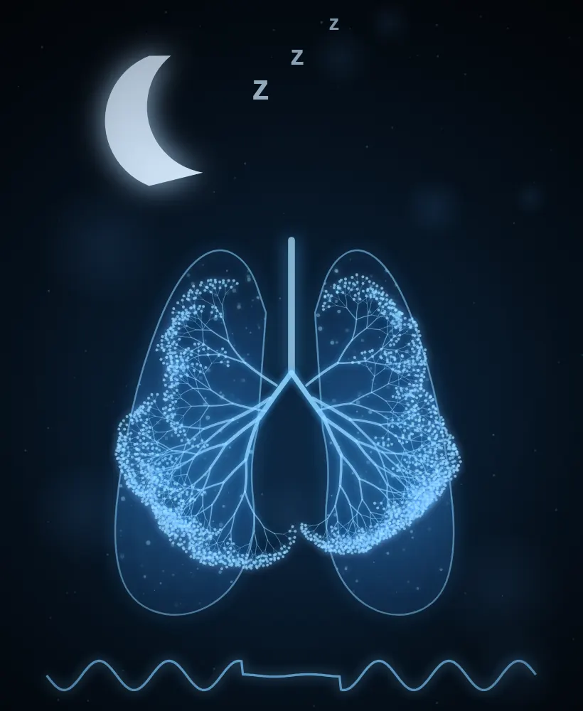 Sleep Study illustration